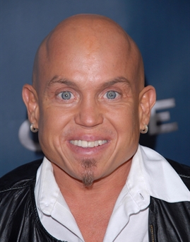 Diễn viên Martin Klebba